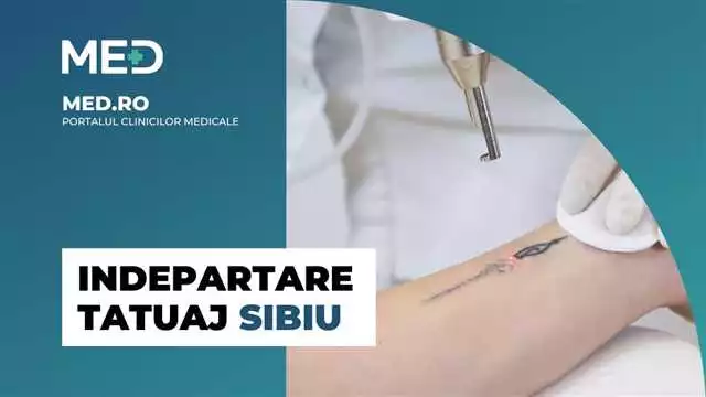 Eliminarea tatuajelor cu Removio în Sibiu: Recenzii, Prețuri și Informații Utile — Removio.ro
