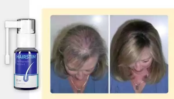 Hairstim prețuri în Reșița — Oferte avantajoase pentru tratamentul căderii părului